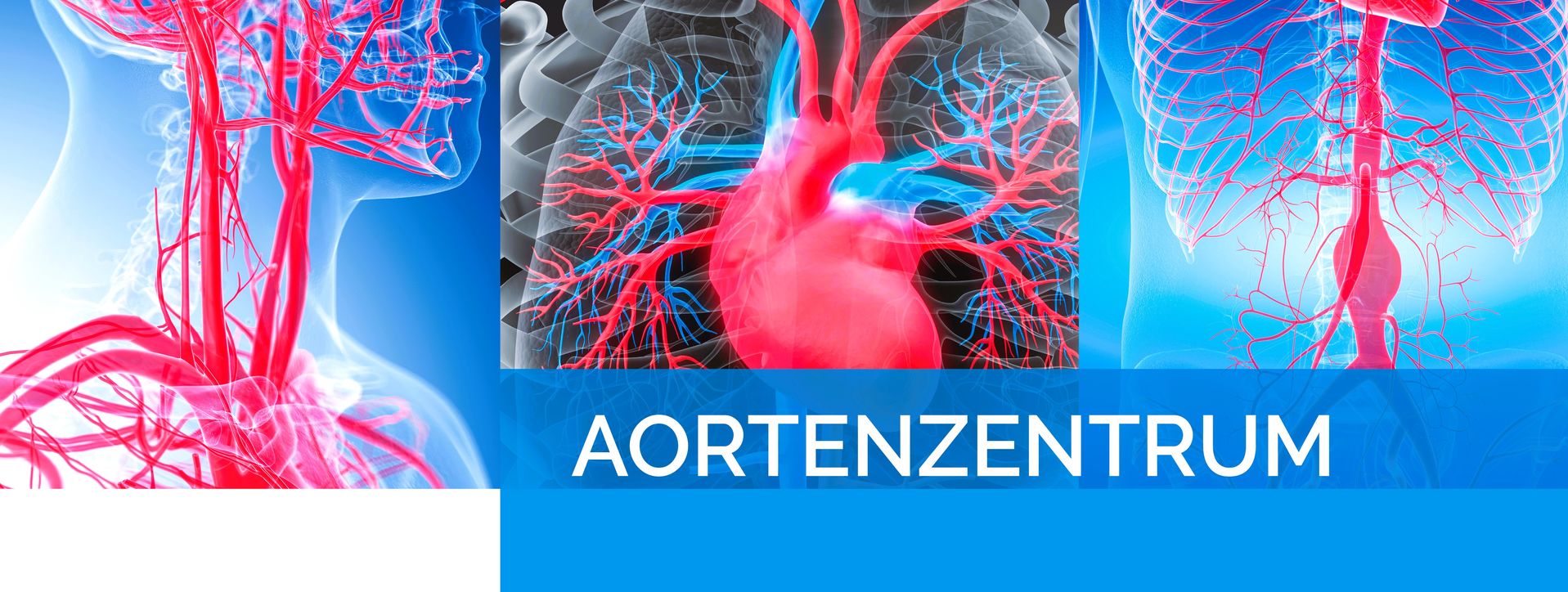 Aortenzentrum an der Kerckhoff-Klinik