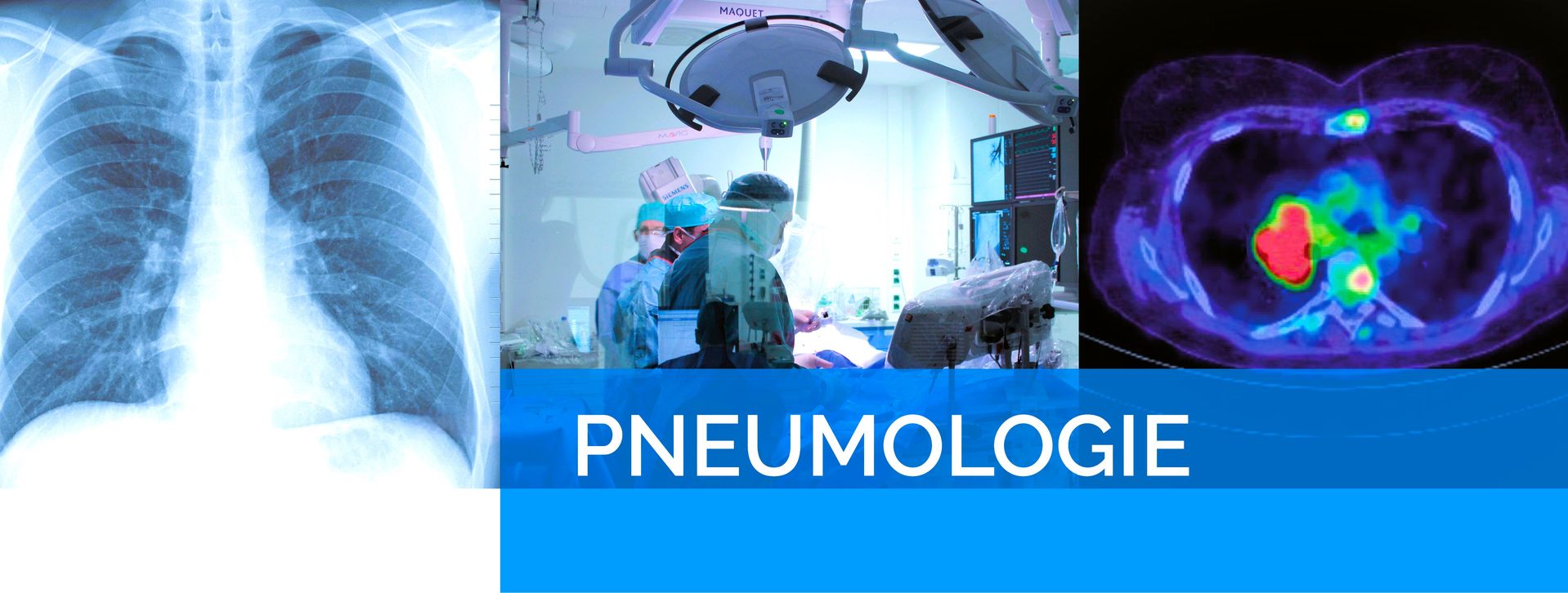 Abteilung Pneumologie an der Kerckhoff-Klinik