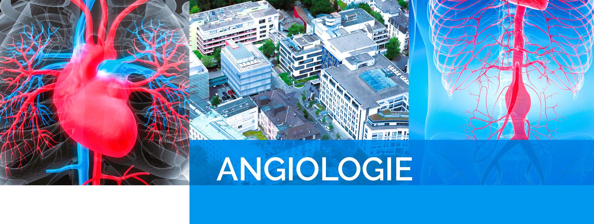 Angiologie an der Kerckhoff-Klinik