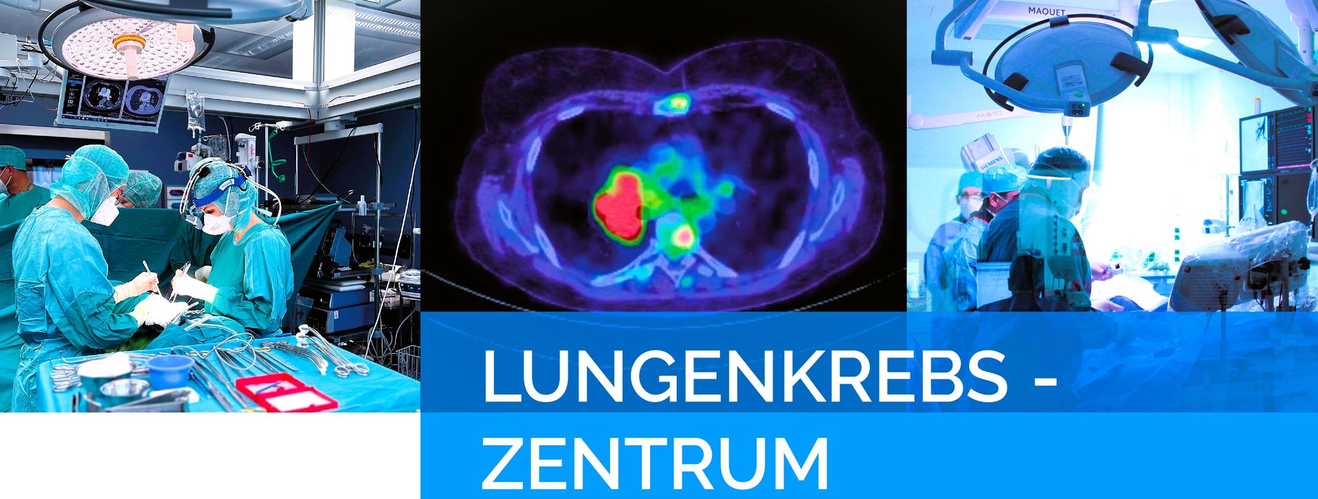 Lungenkrebszentrum Kerckhoff-Klinik