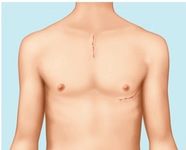 Minimalinvasive Technik