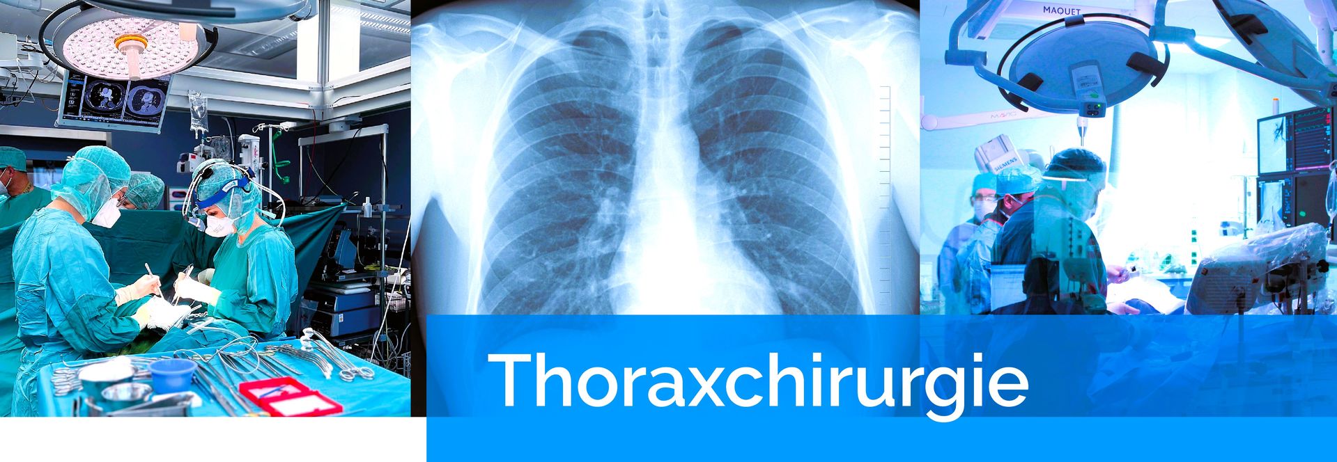 Thoraxchirurgie an der Kerckhoff-Klinik