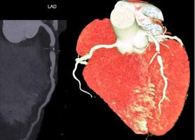 Kardiale Computertomographie