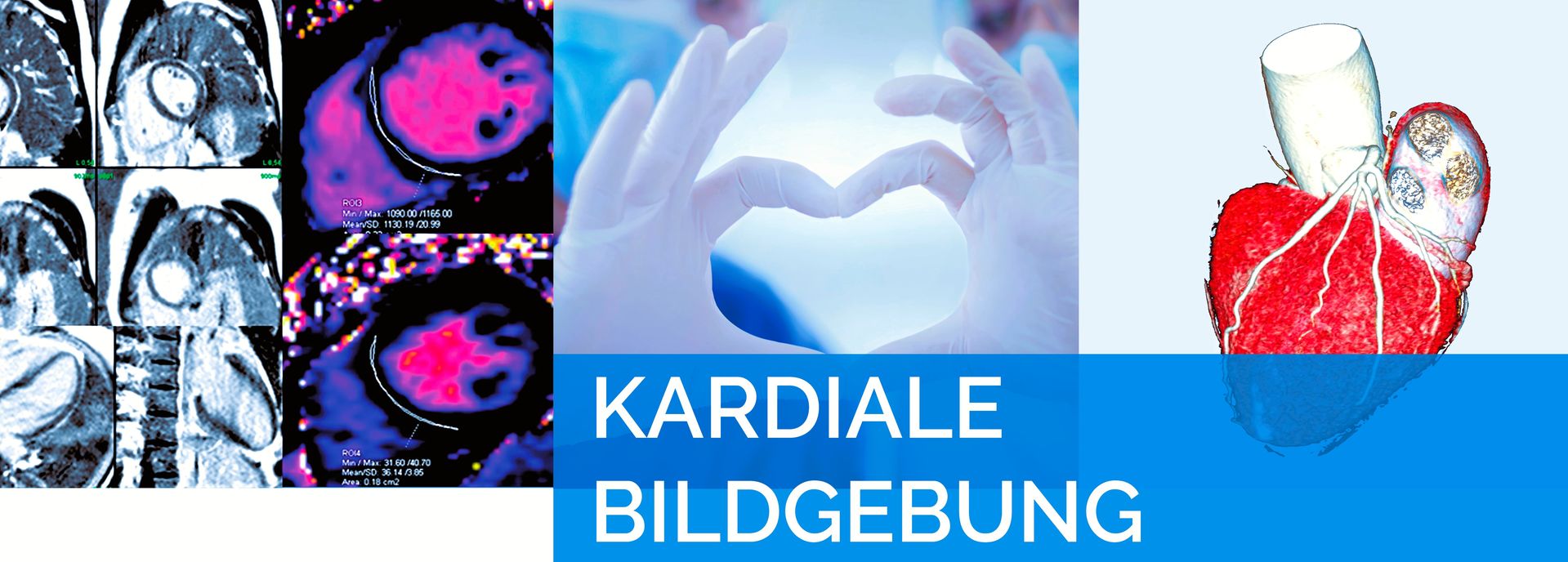 Kardiale Bildgebung